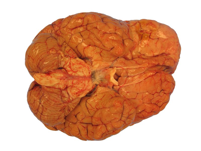 Brain specimen captured with Model 702 system