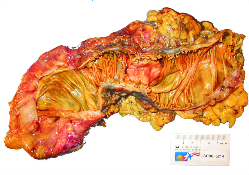 Stomach specimen captured with Model 702 system